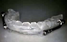 IST-Gerät nach Prof. Hinz