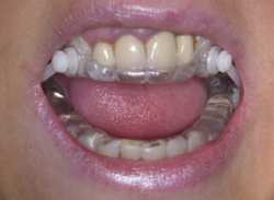 IST-Gerät in Benutzung