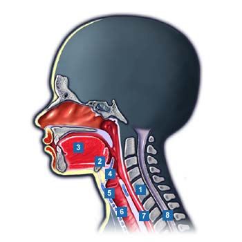 Rückfluss der Magensäure